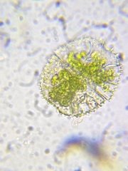 Micrasterias truncata