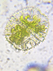 Micrasterias truncata