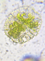 Micrasterias truncata