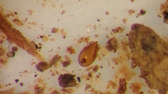 Scheloribatidae