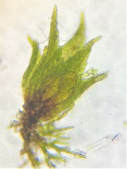 Ephemerum spinulosum