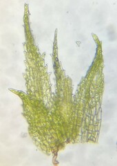Ephemerum spinulosum