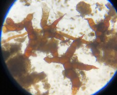 Ephemerum spinulosum