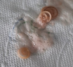 Ascaris lumbricoides