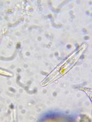 Cymbella