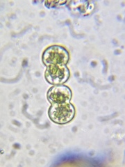 Cosmarium contractum