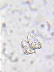 Staurastrum avicula