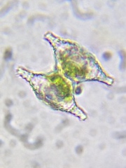 Staurastrum aculeatum