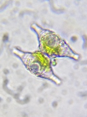 Staurastrum aculeatum