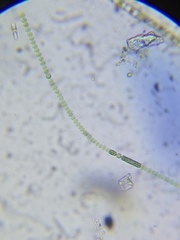 Anabaena aequalis