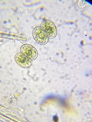 Cosmarium contractum