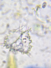 Staurastrum hystrix