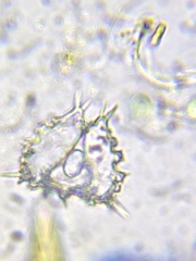 Staurastrum hystrix