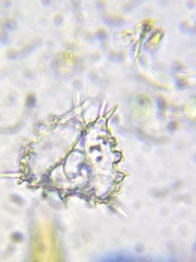 Staurastrum hystrix