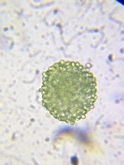 Coelosphaerium