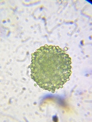 Coelosphaerium