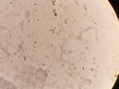 Melanophyllum haematospermum