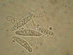 Ascocoryne cylichnium