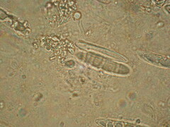 Ascocoryne cylichnium