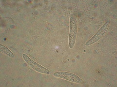 Ascocoryne cylichnium