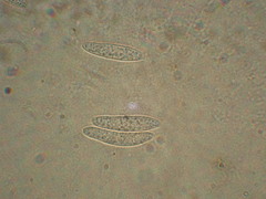 Ascocoryne cylichnium