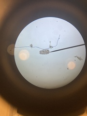 Protozoa