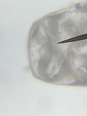 Protozoa