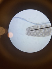 Protozoa