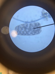 Protozoa