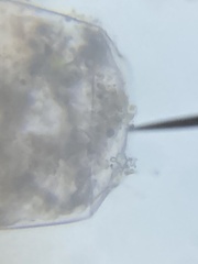 Protozoa