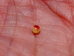 Zopheroteras sphaerula