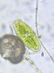 Netrium digitus