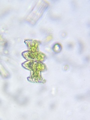 Micrasterias pinnatifida