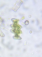 Micrasterias pinnatifida