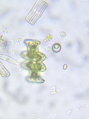 Micrasterias pinnatifida