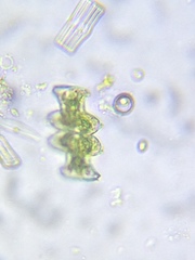 Micrasterias pinnatifida