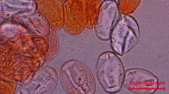 Podosphaera macularis