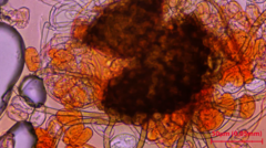 Podosphaera macularis