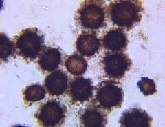 Scleroderma michiganense