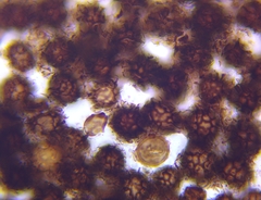 Scleroderma michiganense