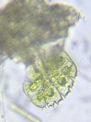 Micrasterias truncata