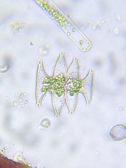 Micrasterias pinnatifida