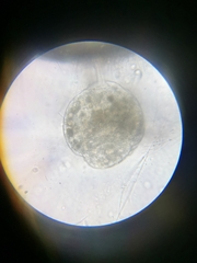 Campanella