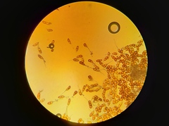Puccinia