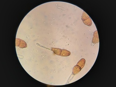 Puccinia