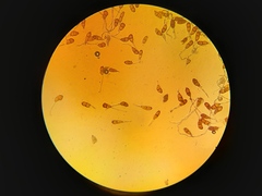 Puccinia