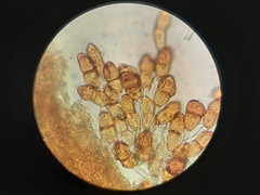 Puccinia