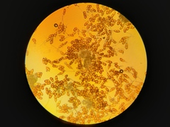 Puccinia