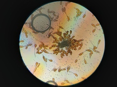 Puccinia