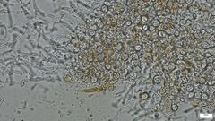 Phaeotremella fimbriata